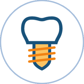 implantaten